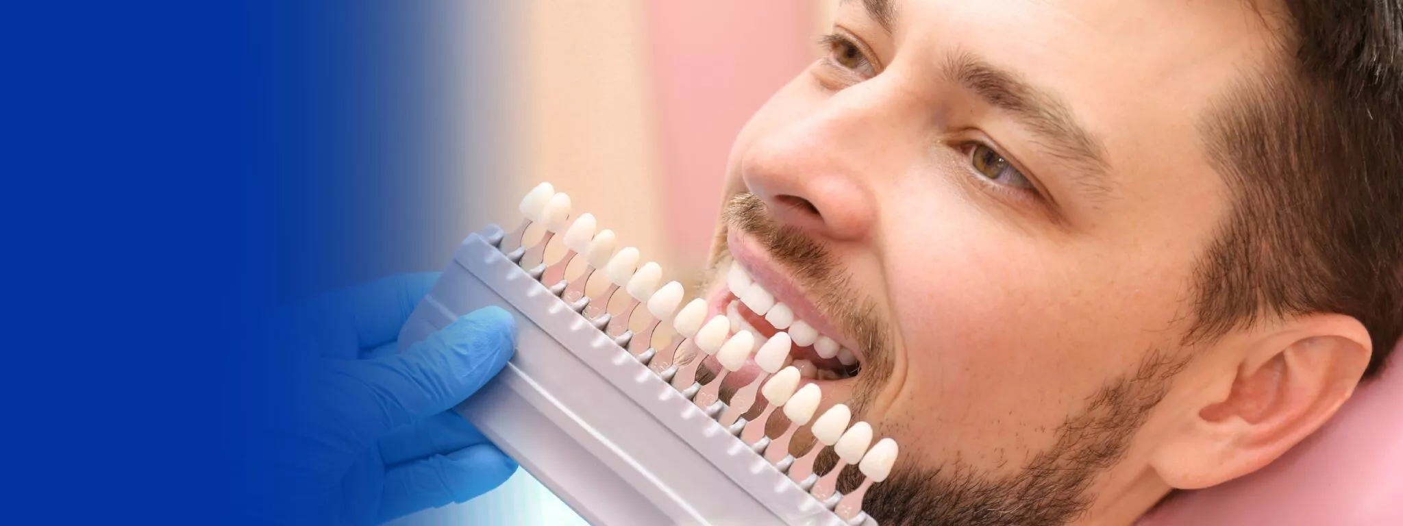 Taller Blanqueamiento Dental